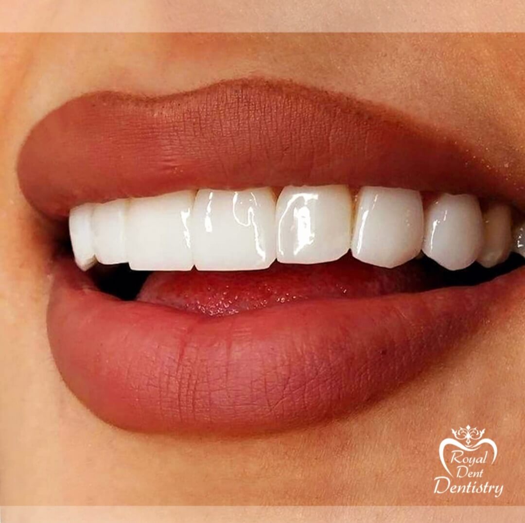 دندانپزشکی تخصصی رویال دنت, ترمیم دندان, متخصص ارتودنسی,ارتودنسی کودکان,لیرینگ دندان,کامپوزیت ونیر,