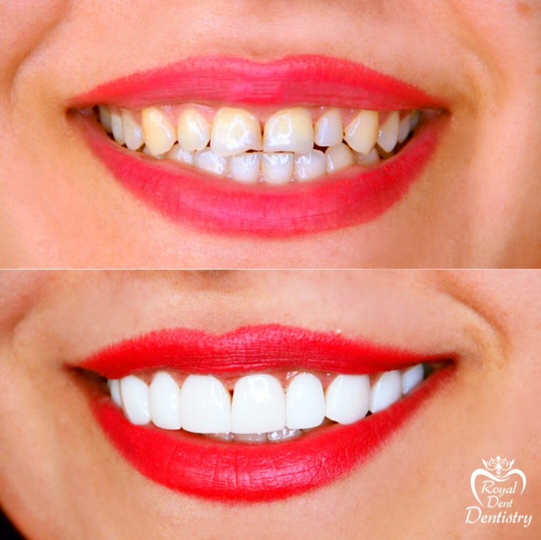 دندانپزشکی تخصصی رویال دنت, ترمیم دندان, متخصص ارتودنسی,ارتودنسی کودکان,لیرینگ دندان,کامپوزیت ونیر,